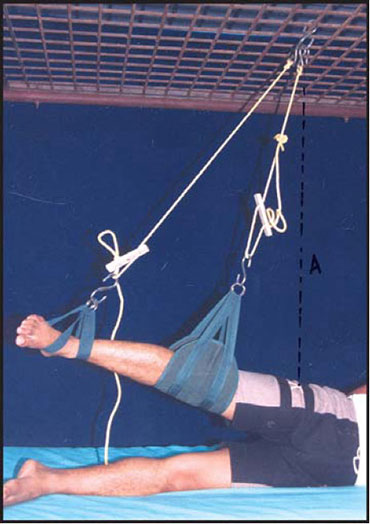 Exercise therapy